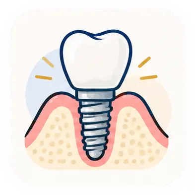 TCLE Implantes Dentários