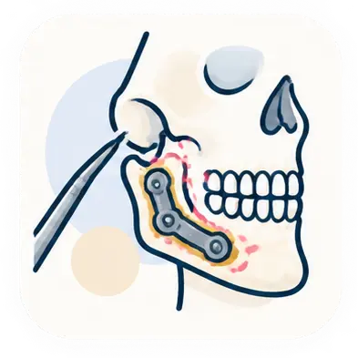 TCLE Cirurgia Bucomaxilofacial