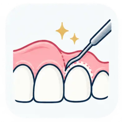 TCLE Cirurgia Plástica Gengival