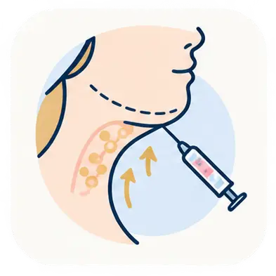 TCLE Hidrolipoclasia Não Aspirativa